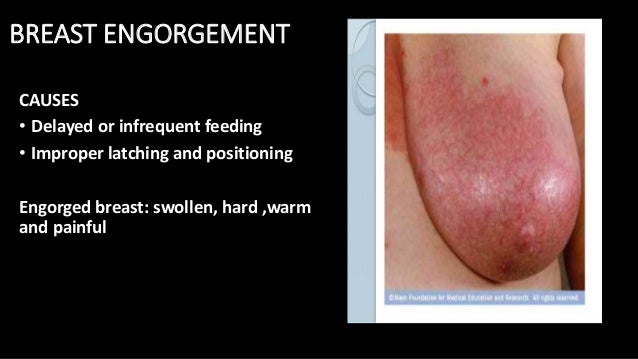 swollen breast breastfeeding Cum his pants